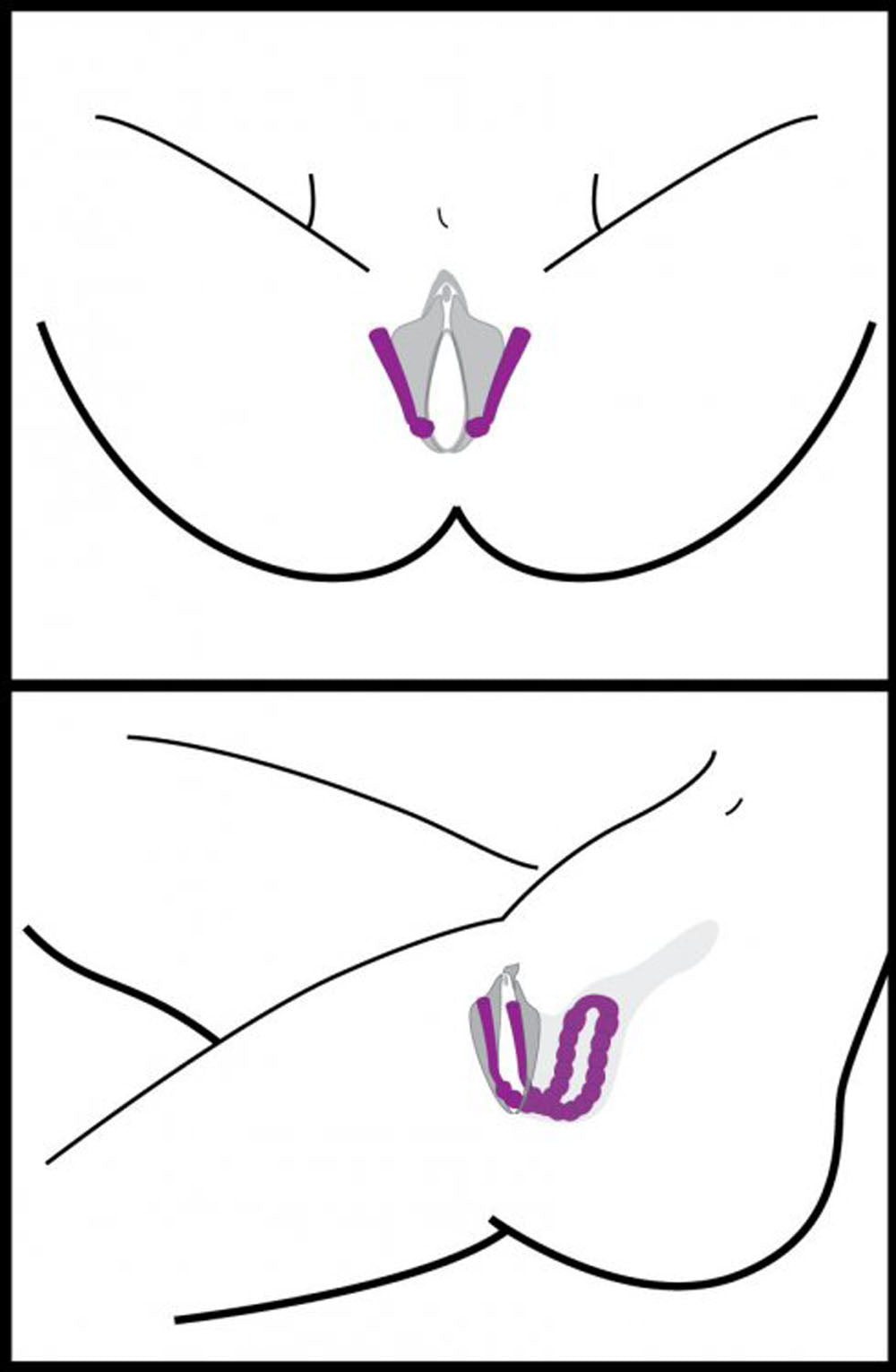 XR Brands Oral Enhancing Hands Free Labia Spreader – Purple